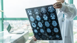 How The Moses Firm: Medical Malpractice Lawyers Can Help Following Infant Brain Damage in Atlanta, GA?