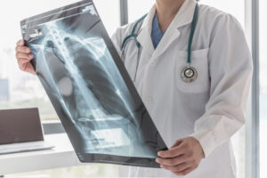 What Is a Chest Injury?